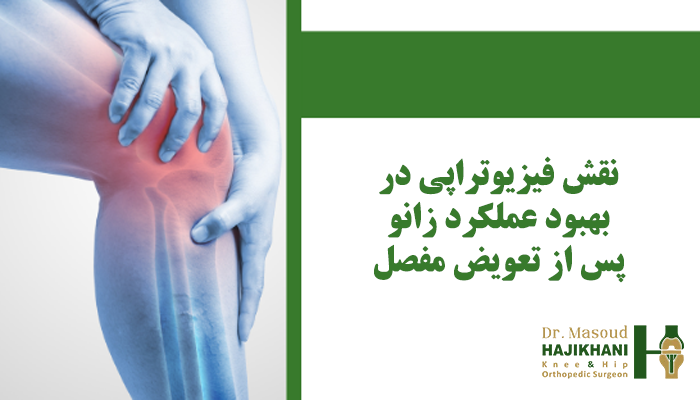 نقش فیزیوتراپی در بهبود عملکرد زانو پس از تعویض مفصل
