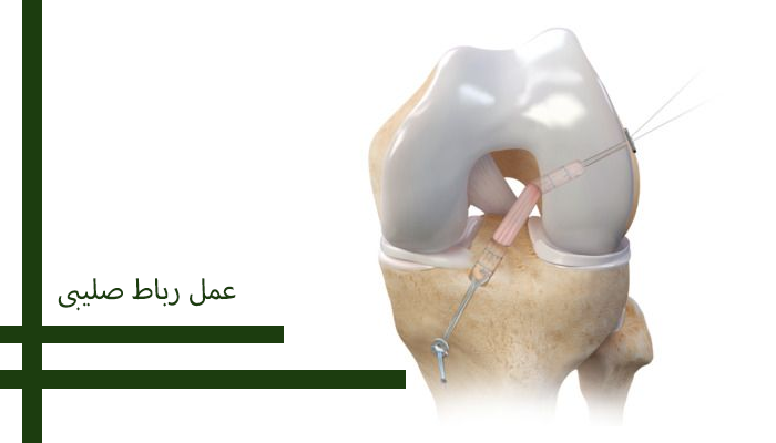 عمل رباط صلیبی 
