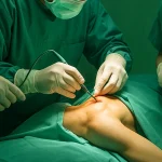جراحی شانه بهتر است یا تزریق داخل مفصلی