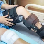 مراقبت های بعد از عمل شکستگی زانو