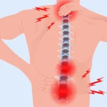 آرتروز ستون فقرات