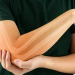 دلایل شایع پارگی تاندون آرنج در ورزشکاران