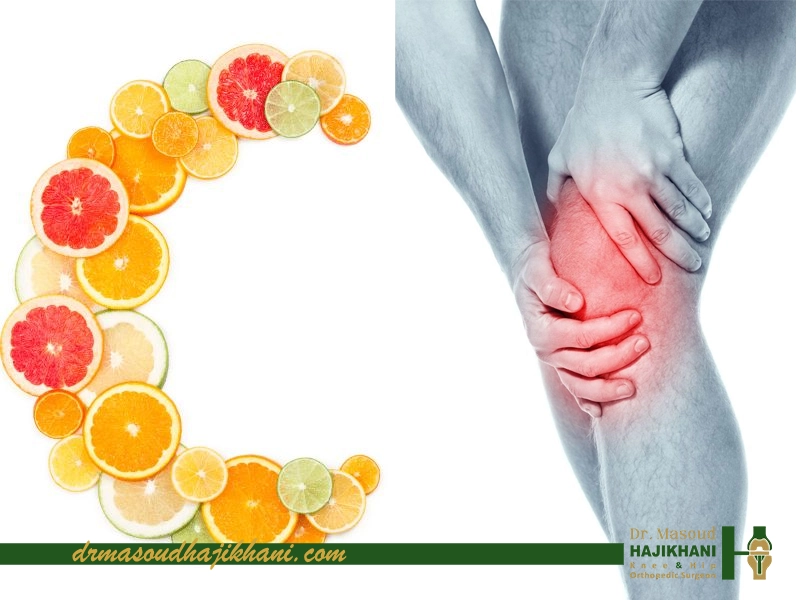 کمبود ویتامین C و افزایش صدای مفصل