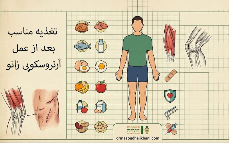 تغذیه مناسب بعد از عمل آرتروسکوپی زانو