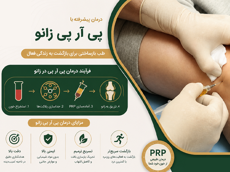 پی آر پی زانو
